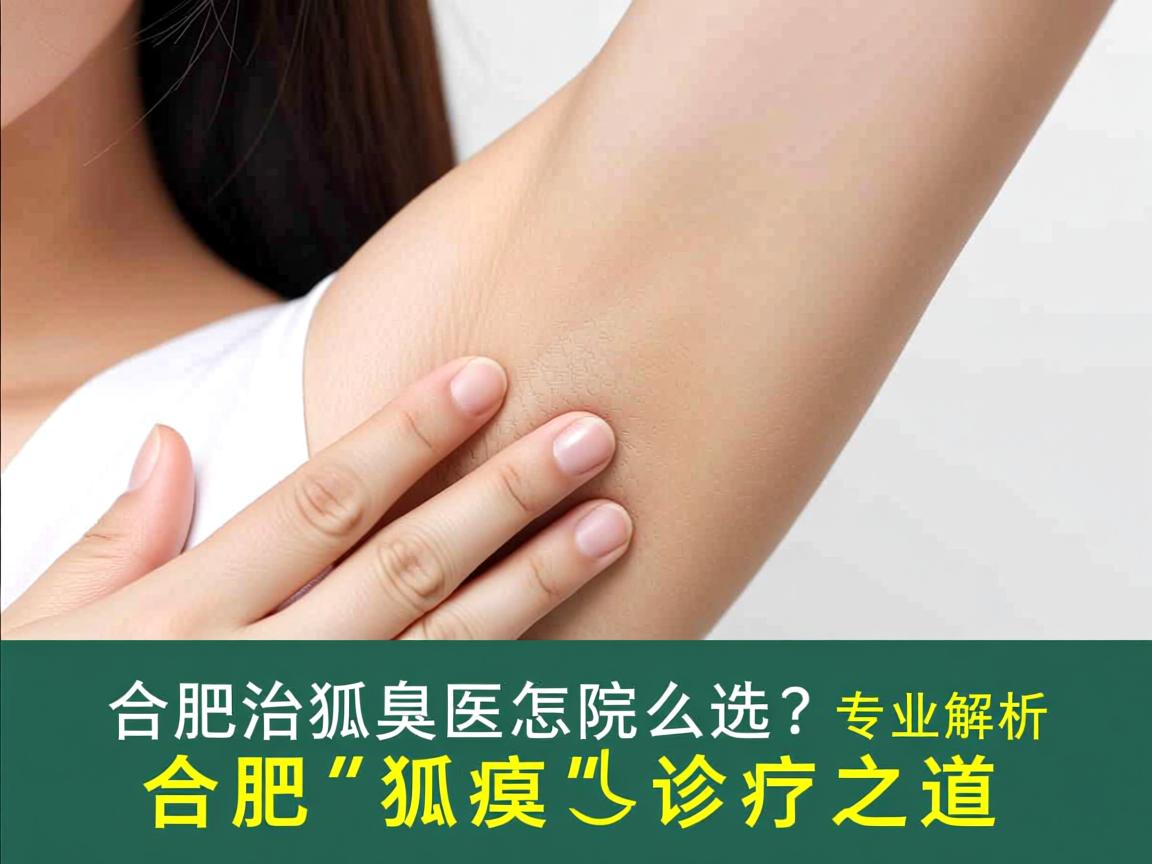 合肥治狐臭医院怎么选？专业解析合肥狐臭诊疗之道