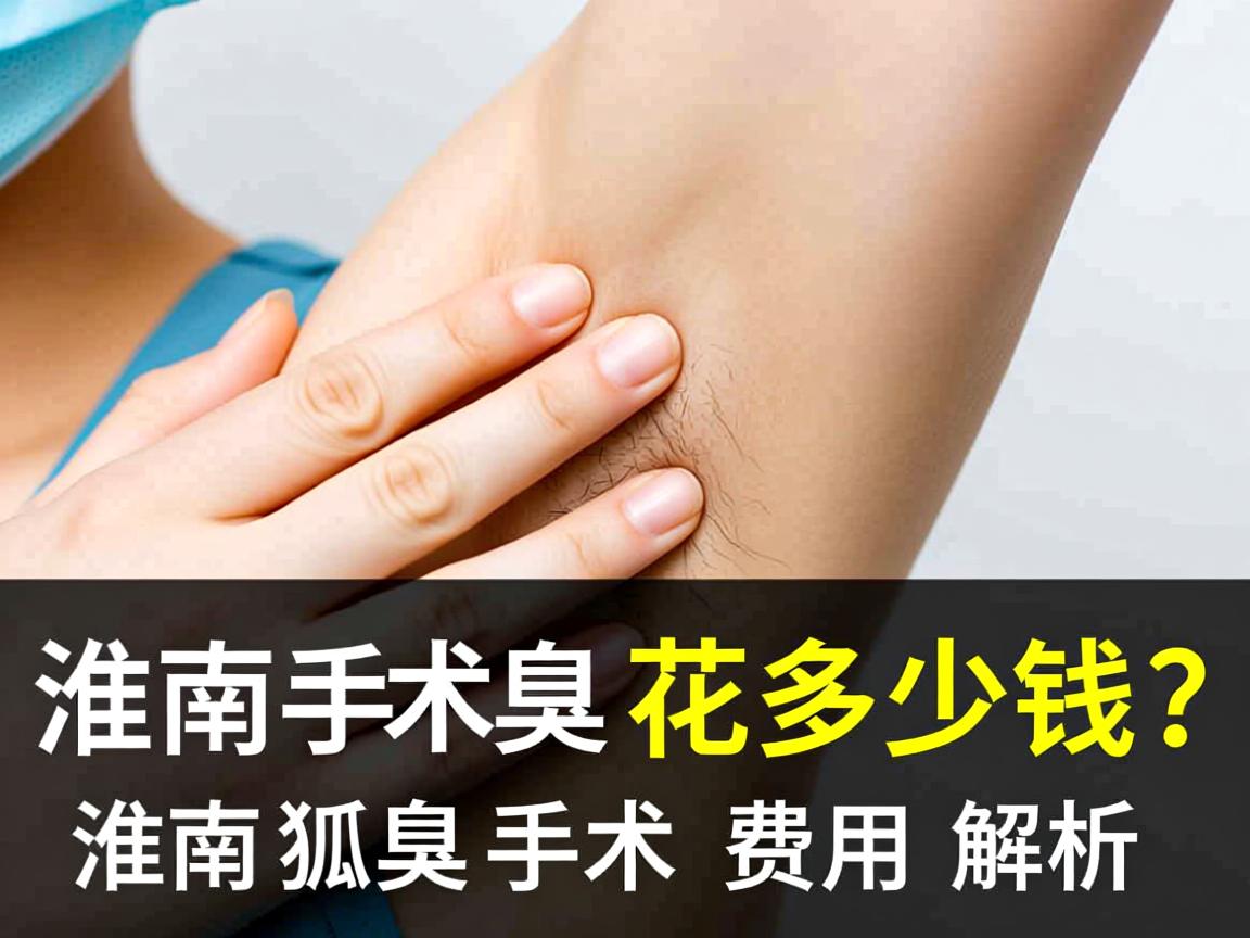 淮南狐臭手术花多少钱?淮南狐臭手术费用解析 淮南狐臭手术花多少钱?淮南狐臭手术费用解析