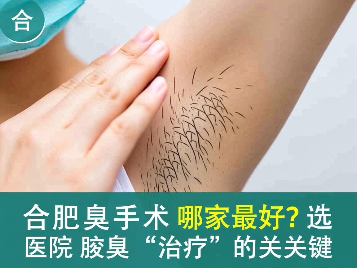 合肥腋臭手术哪家最好？选对医院是腋臭治疗的关键