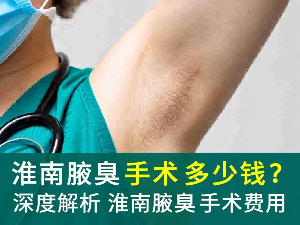 淮南腋臭手术多少钱？深度解析淮南腋臭手术费用