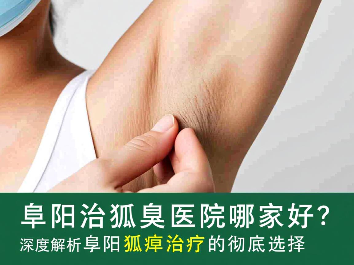 阜阳治狐臭医院哪家好?深度解析阜阳狐臭治疗的彻底选择 阜阳治狐臭医院哪家好?深度解析阜阳狐臭治疗的彻底选择