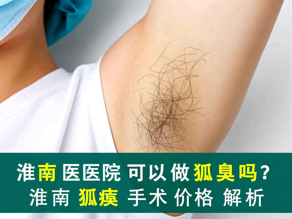 淮南医院可以做狐臭吗?淮南狐臭手术价格解析 淮南医院可以做狐臭吗?淮南狐臭手术价格解析