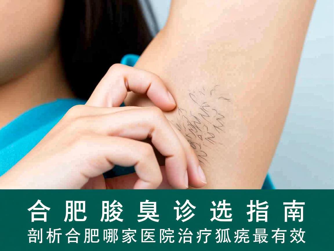 合肥腋臭诊疗选择指南，剖析合肥哪家医院治疗狐臭最有效