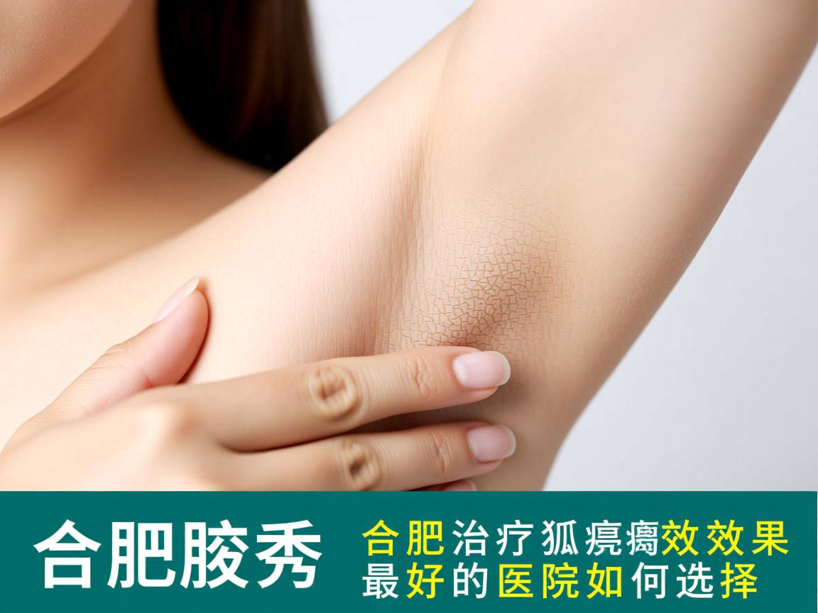 合肥腋秀解析，合肥治疗狐臭效果最好的医院如何选择