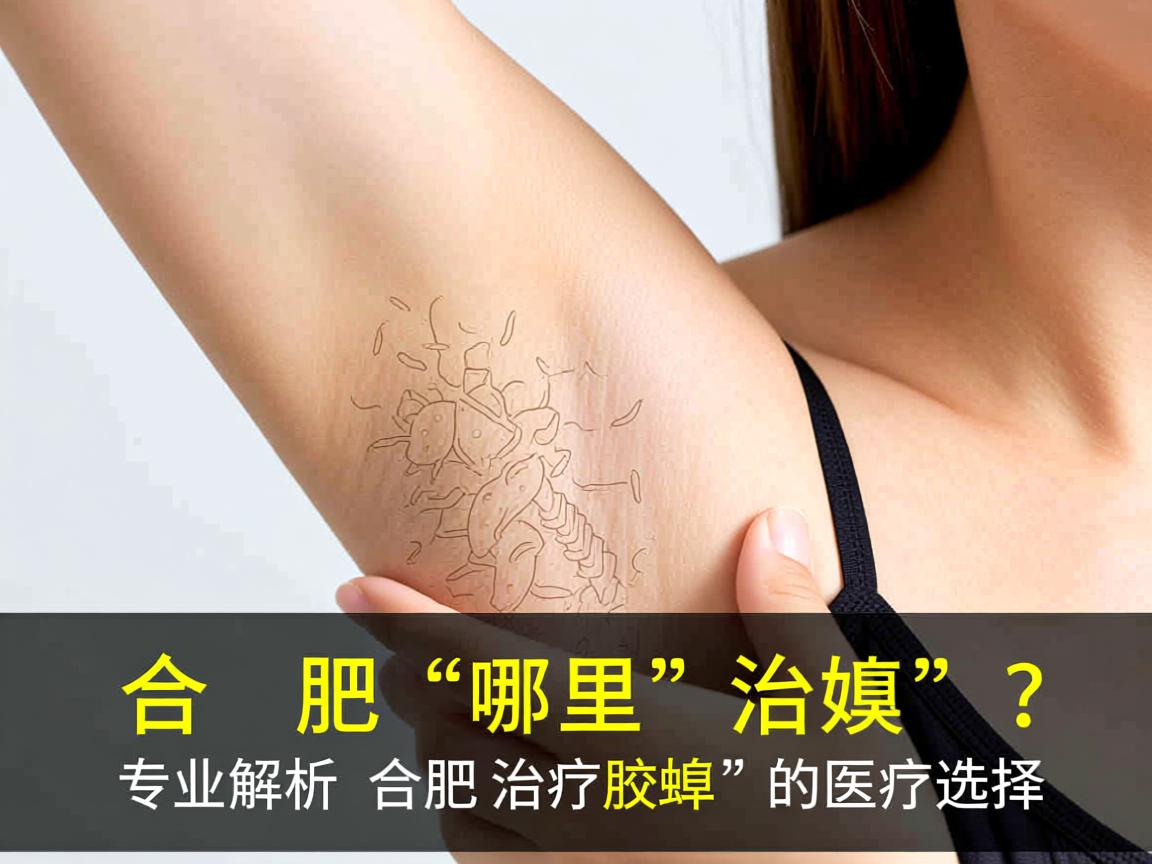 合肥哪里治腋臭？专业解析合肥治疗腋臭的医疗选择