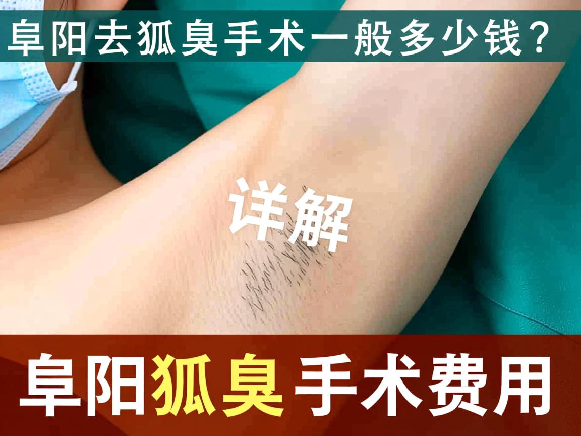 阜阳去狐臭手术一般多少钱?详解阜阳狐臭手术费用 阜阳去狐臭手术一般多少钱?详解阜阳狐臭手术费用