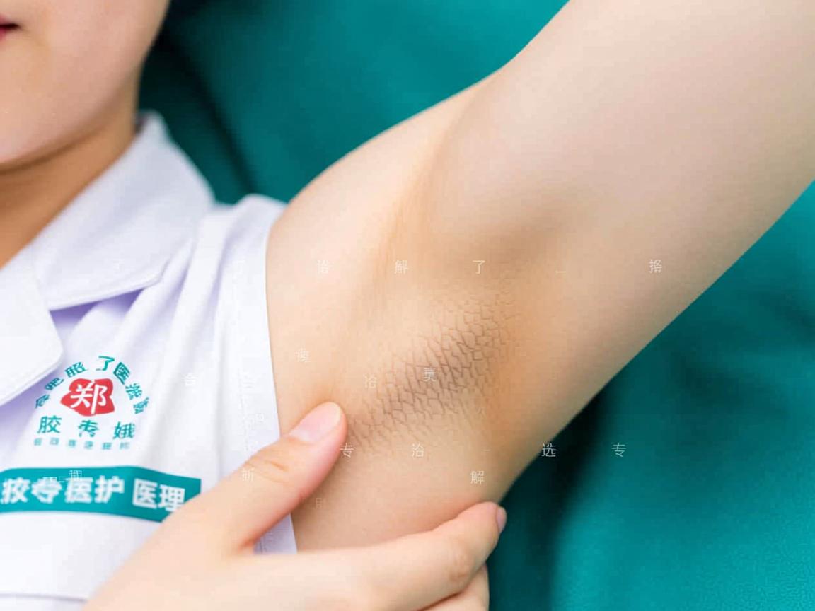 了解腋臭治疗选择 合肥腋秀医院郑传娥解析专业腋臭医疗护理