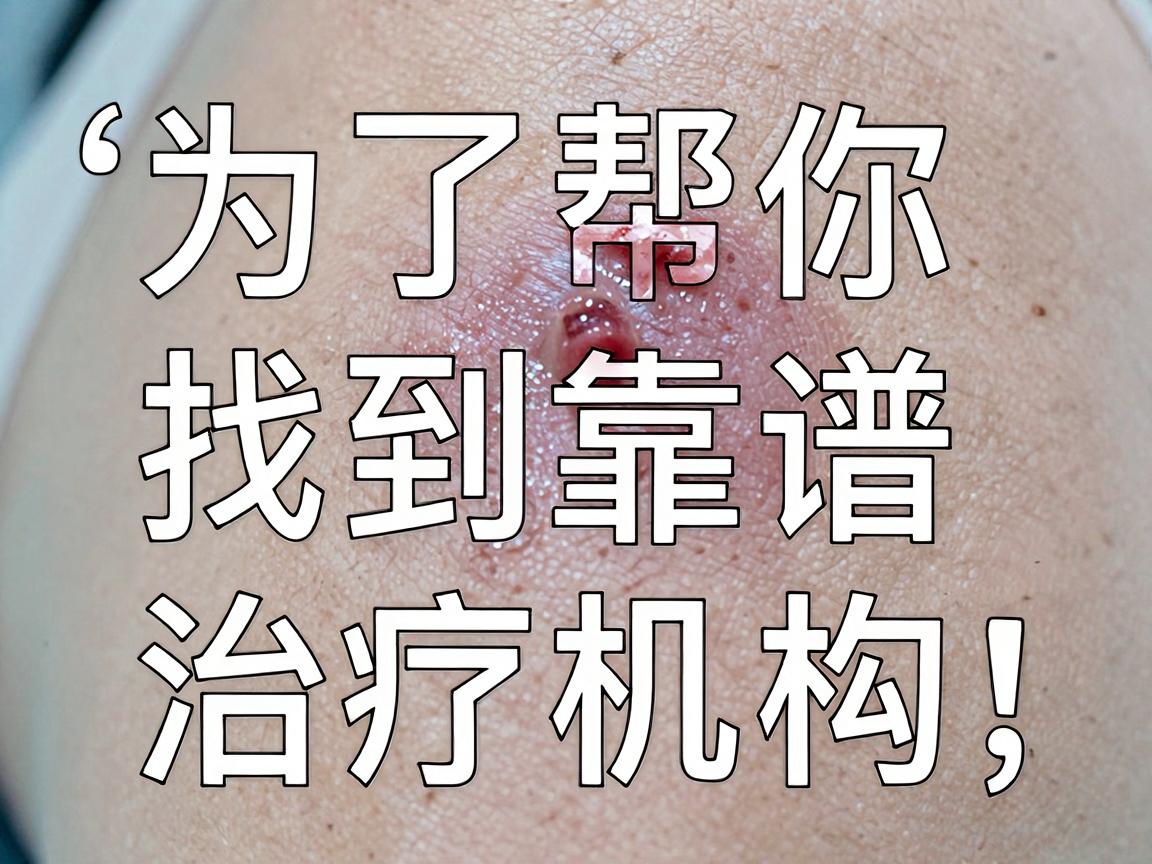 为了帮你找到靠谱的治疗机构，我建议你参考以下权威且实用的方法
