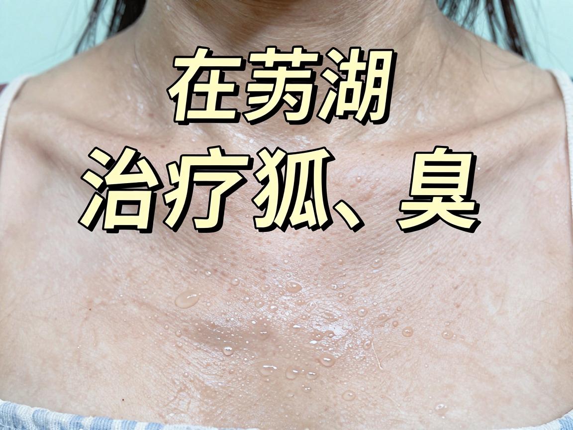 在芜湖,治疗狐臭(腋臭)的医疗资源主要集中在几家大型公立医院的整形美容科或普外科(腋臭专科)选择医院时,建议优先考虑公立三甲医院,因为其设备更先进、医生经验更丰富,且收费相对透明 在芜湖,治疗狐臭(腋臭)的医疗资源主要集中在几家大型公立医院的整形美容科或普外科(腋臭专科)选择医院时,建议优先考虑公立三甲医院,因为其设备更先进、医生经验更丰富,且收费相对透明