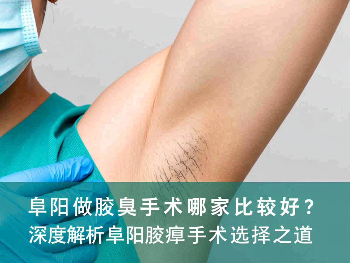 阜阳做腋臭手术哪家比较好？深度解析阜阳腋臭手术选择之道