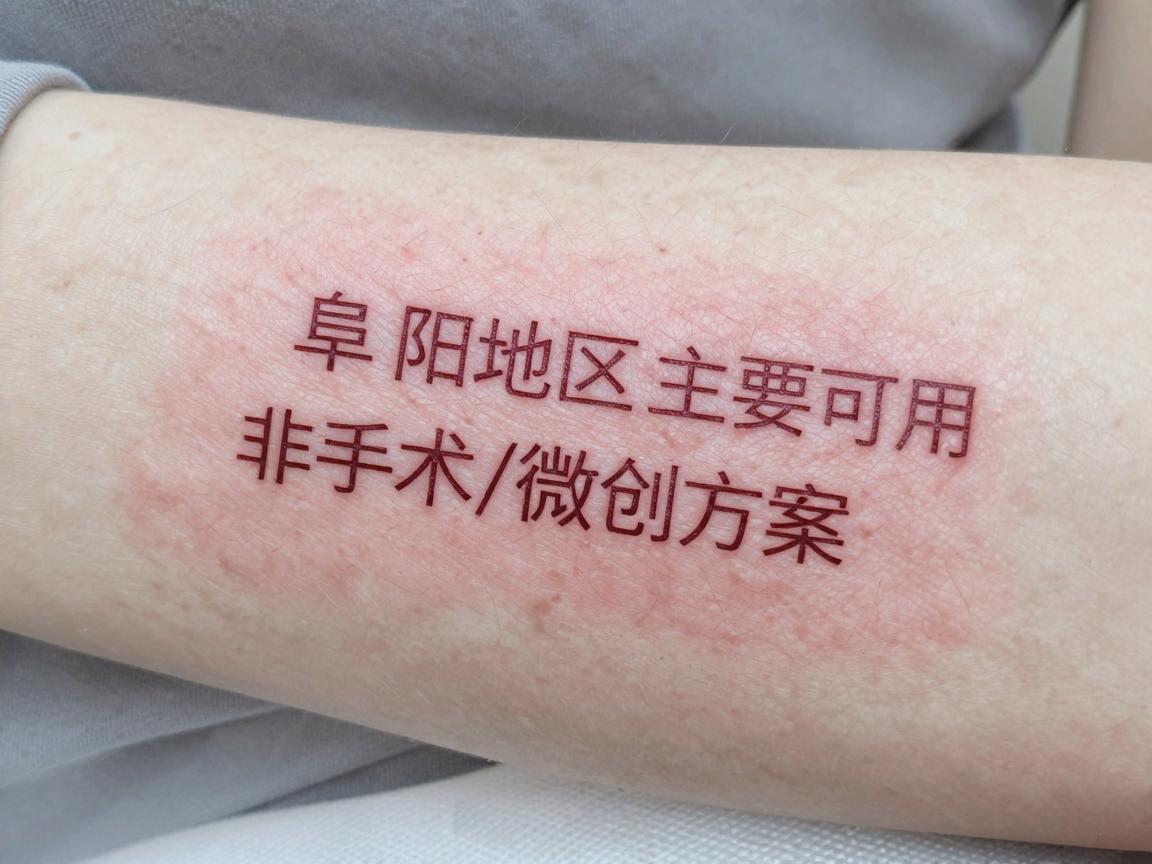 阜阳地区主要可用的非手术/微创方案 阜阳地区主要可用的非手术/微创方案