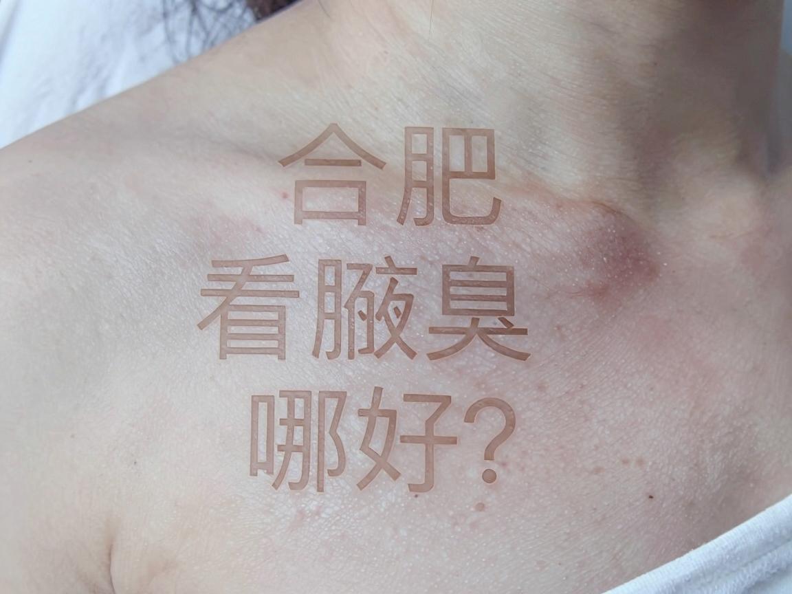 合肥看腋臭哪家医院好？今天聊聊腋臭治疗医院的那些门道
