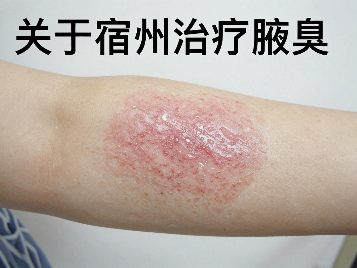关于宿州治疗腋臭的医院，目前没有名为宿州腋臭医院的独立专科机构，但宿州市有多家公立医院设有普外科或皮肤科，可以提供腋臭（狐臭）的诊疗服务