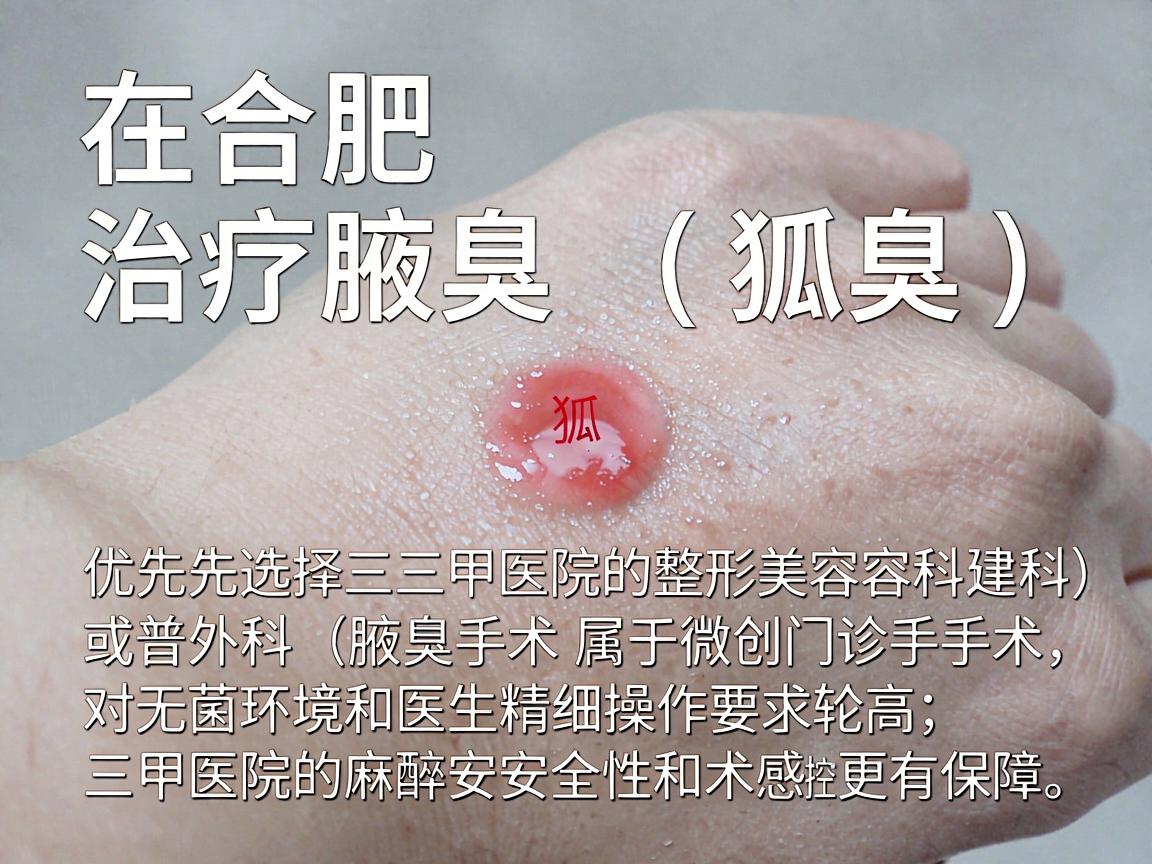 在合肥,治疗腋臭(狐臭)建议优先选择三甲医院的整形美容科或普外科(腋臭专科)因为腋臭手术属于微创门诊手术,对无菌环境和医生精细操作要求较高,三甲医院的麻醉安全性和术后感染控制方面更有保障 在合肥,治疗腋臭(狐臭)建议优先选择三甲医院的整形美容科或普外科(腋臭专科)因为腋臭手术属于微创门诊手术,对无菌环境和医生精细操作要求较高,三甲医院的麻醉安全性和术后感染控制方面更有保障