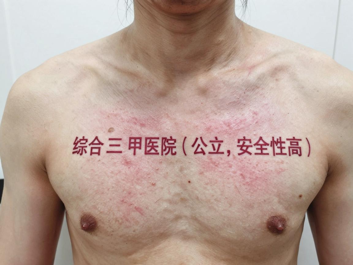 综合三甲医院（公立，安全性高）