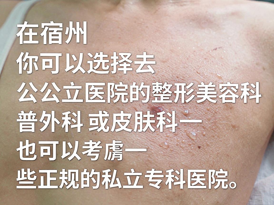 在宿州,你可以选择去公立医院的整形美容科、普外科或皮肤科,也可以考虑一些正规的私立专科医院。以下是具体的推荐和注意事项 在宿州,你可以选择去公立医院的整形美容科、普外科或皮肤科,也可以考虑一些正规的私立专科医院。以下是具体的推荐和注意事项