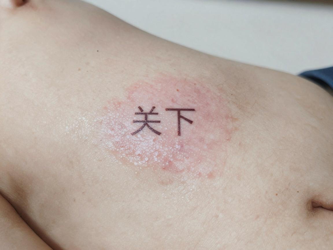 关于狐臭的医学解释 关于狐臭的医学解释
