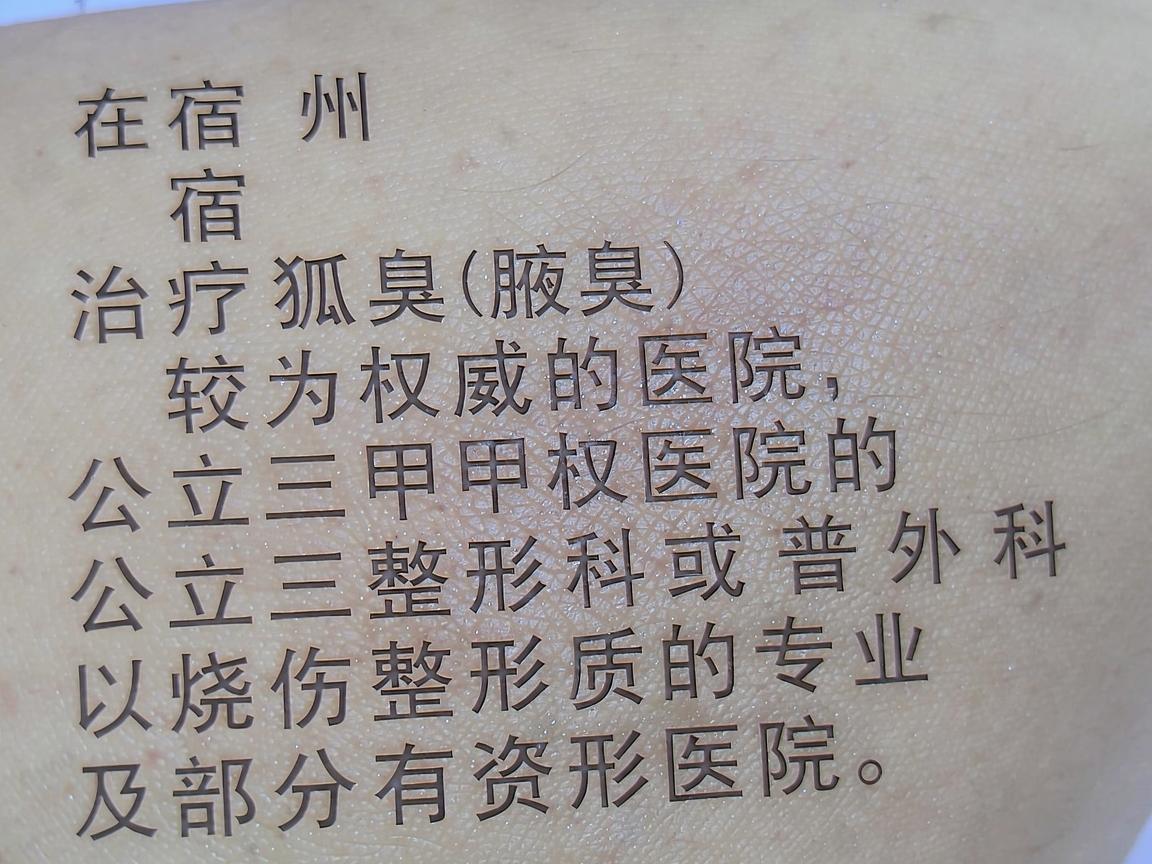 在宿州,治疗狐臭(腋臭)较为权威的医院通常包括公立三甲医院的烧伤整形科或普外科,以及部分有资质的专业整形医院。以下是几家在当地口碑较好、技术相对成熟的医院及科室推荐 在宿州,治疗狐臭(腋臭)较为权威的医院通常包括公立三甲医院的烧伤整形科或普外科,以及部分有资质的专业整形医院。以下是几家在当地口碑较好、技术相对成熟的医院及科室推荐